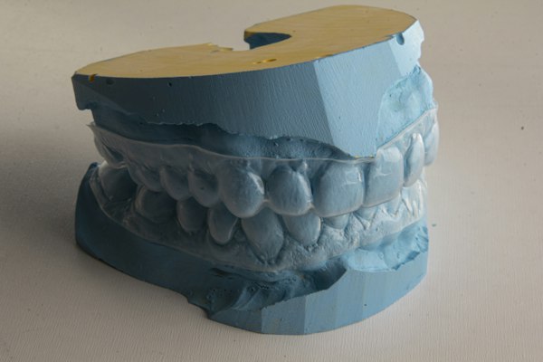 Clearcorrect 1