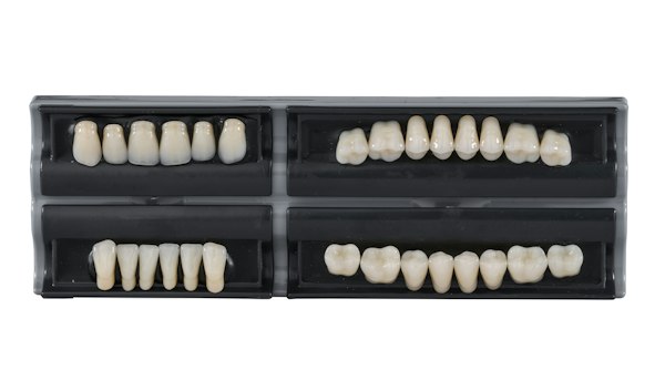 Metal Ceramic Crown