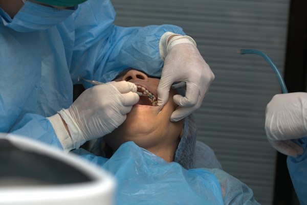 Wisdom Tooth Extraction